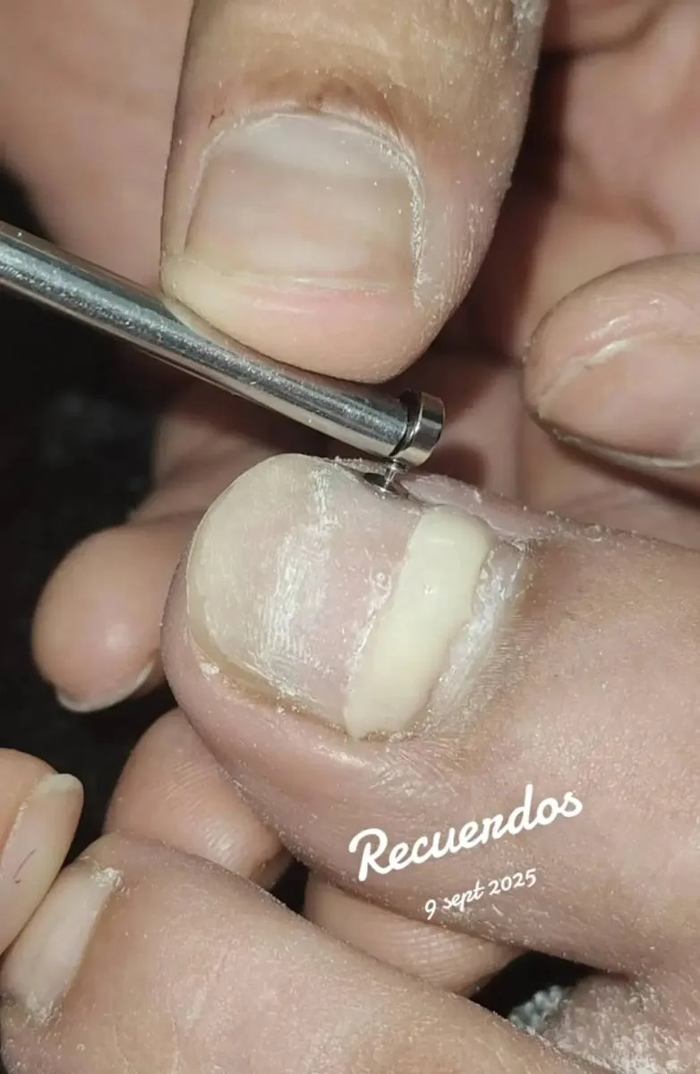LEIVA 6
