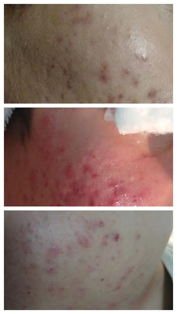 VeyraEstética cosmiatra 4