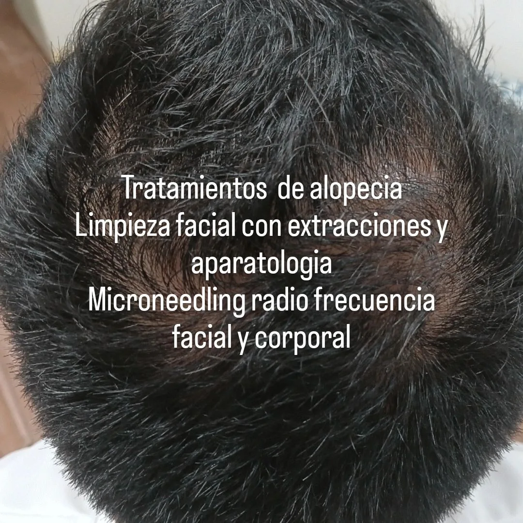 VeyraEstética cosmiatra 5