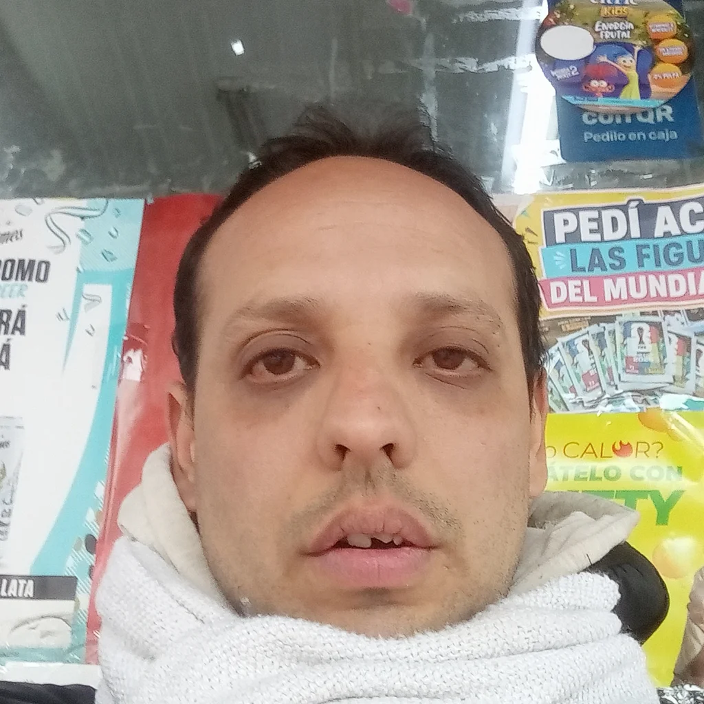 Diego suarez
