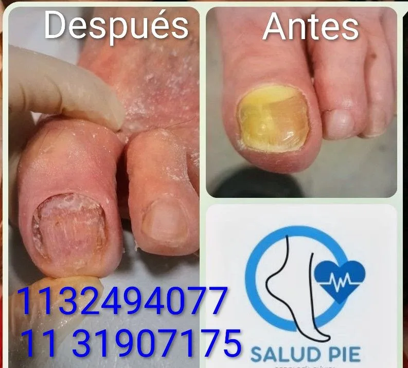 Salud Pie 5